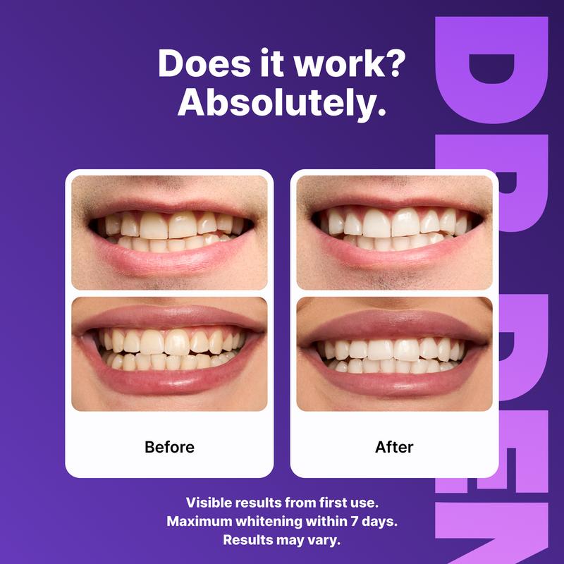 Instant Radiance Purple Whitening Strips