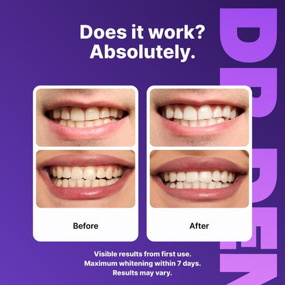Instant Radiance Purple Whitening Strips